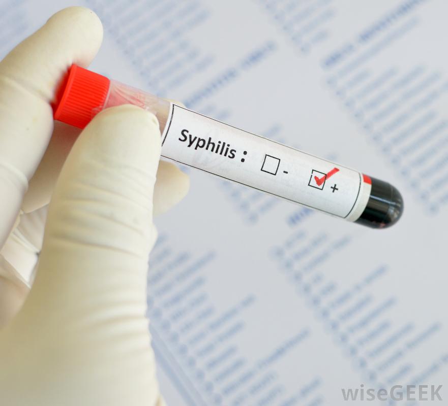 性病检测试剂盒有哪些不同类型(Different Types of STD Test Kits)？图1