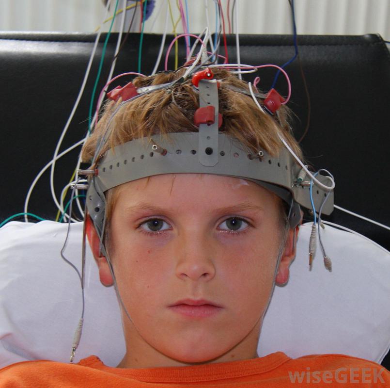 什么是生物反馈(Biofeedback)？