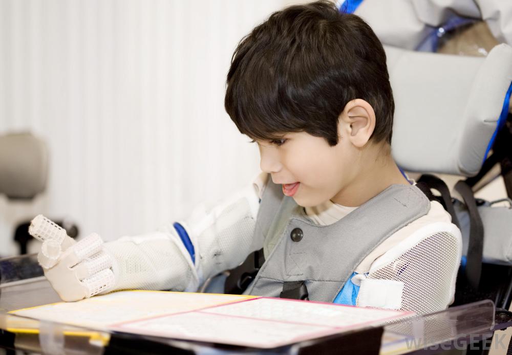 什么是痉挛性双瘫脑瘫(Spastic Diplegic Cerebral Palsy)？图1