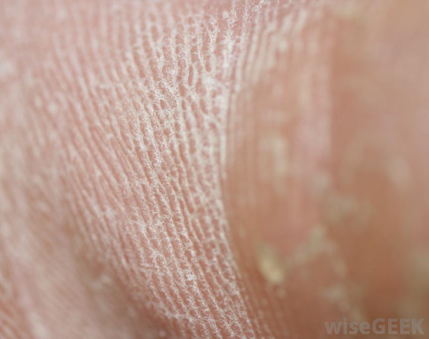 什么是老茧剃须刀(Callus Shaver)？图2