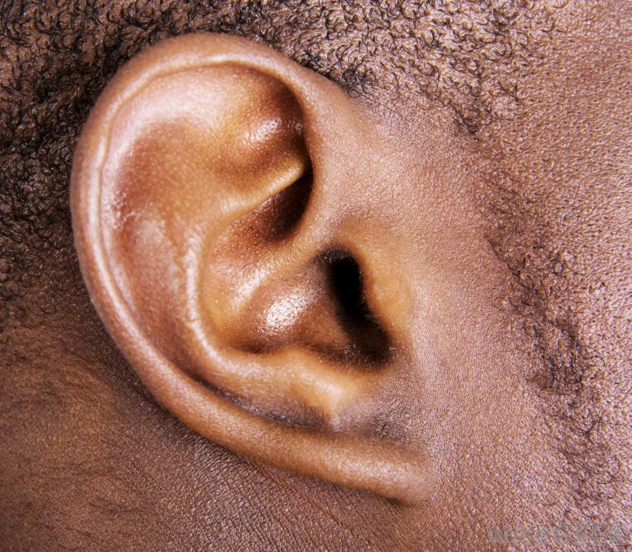 如何去除耳部黑头(Remove an Ear Blackhead)？图1