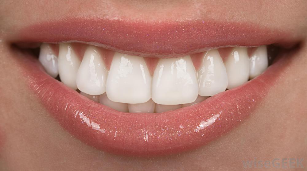 什么是磨砂牙膏(Abrasive Toothpaste)？图2