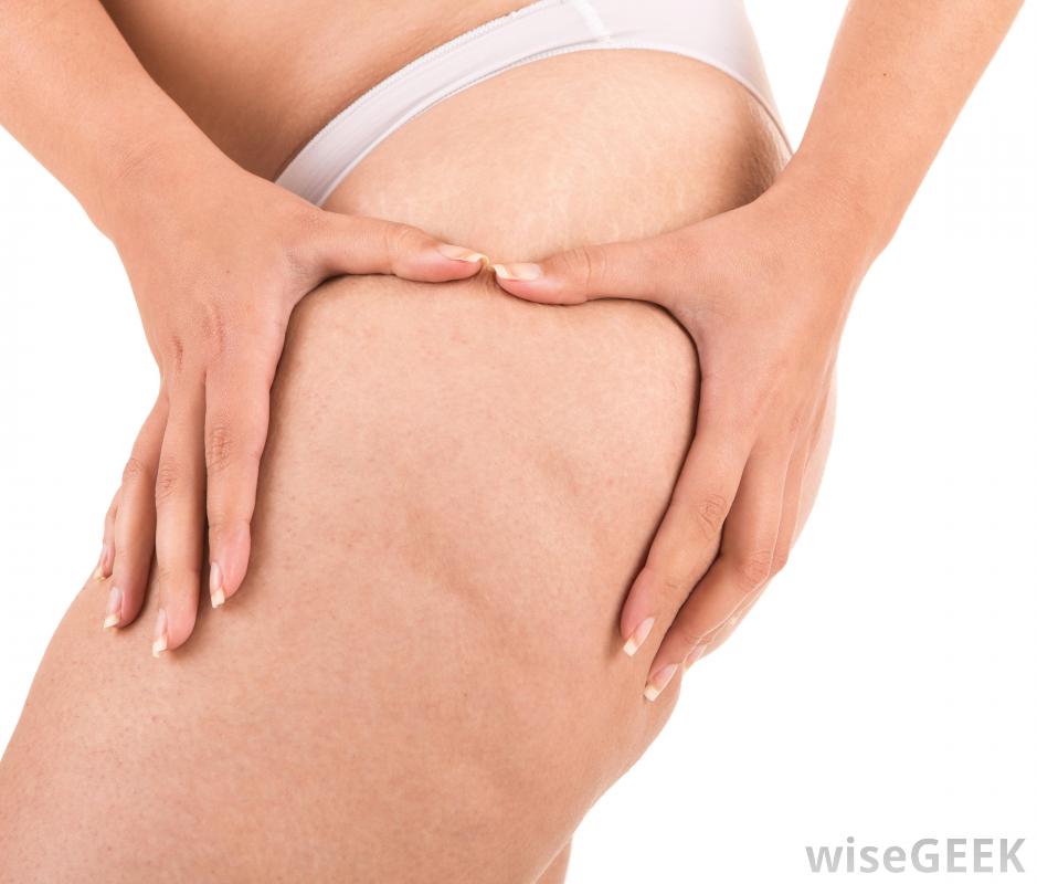 什么是脂肪团刷子(Cellulite Brush)？图1