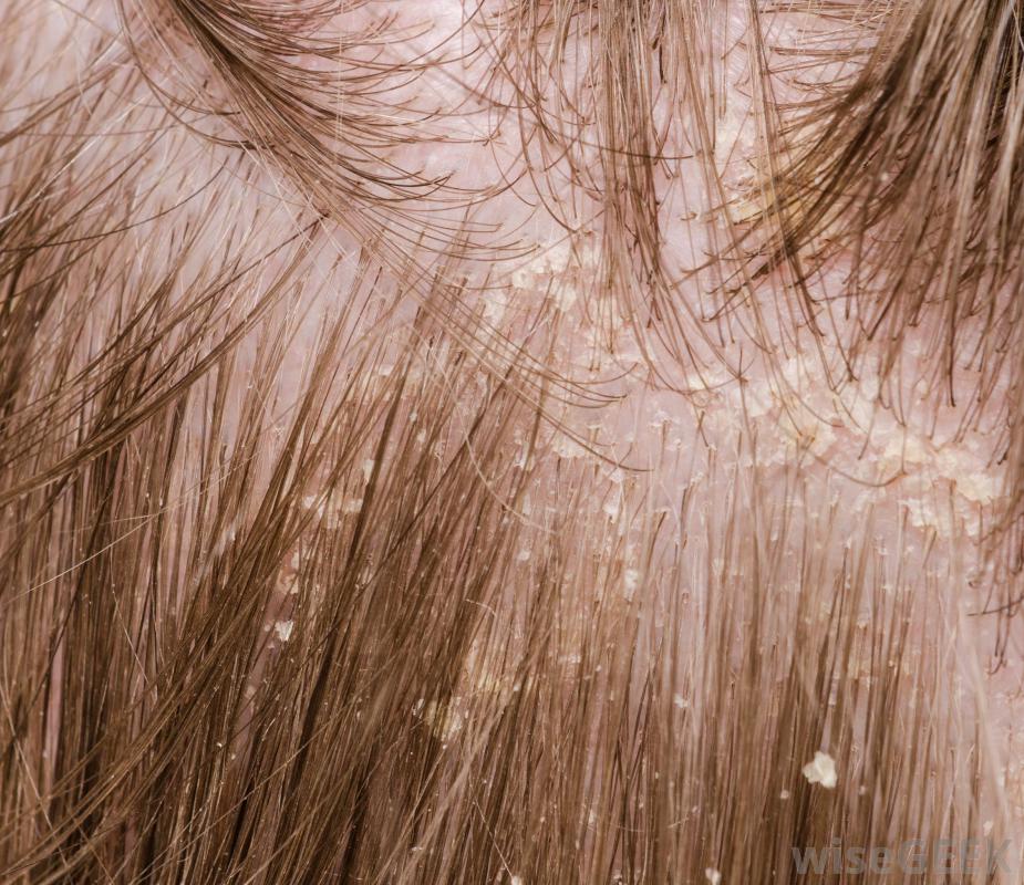 使用死海泥有什么好处(Benefits Using Dead Sea Mud)？图2